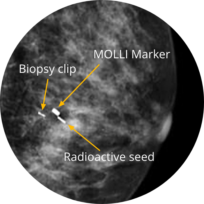 Imaging Molli Surgical 7661