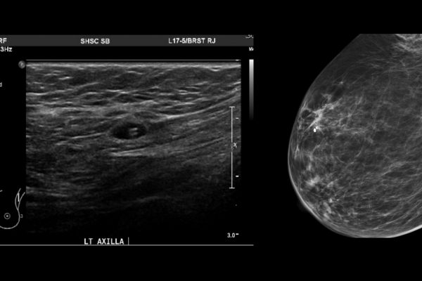 MOLLI_Ultrasound_Images4